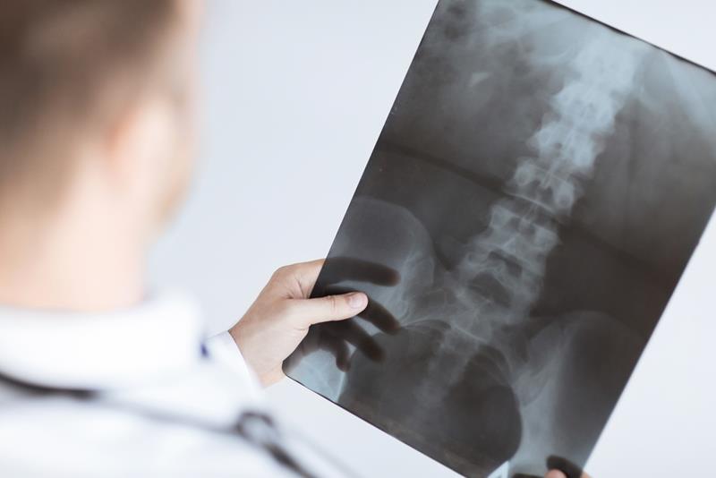 X-Rays 